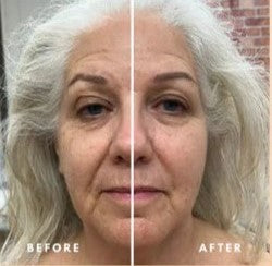 LOUKA™ Lymphatic Face Brush